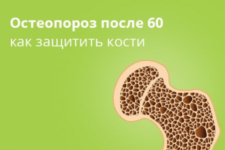 Остеопороз у женщин после 60